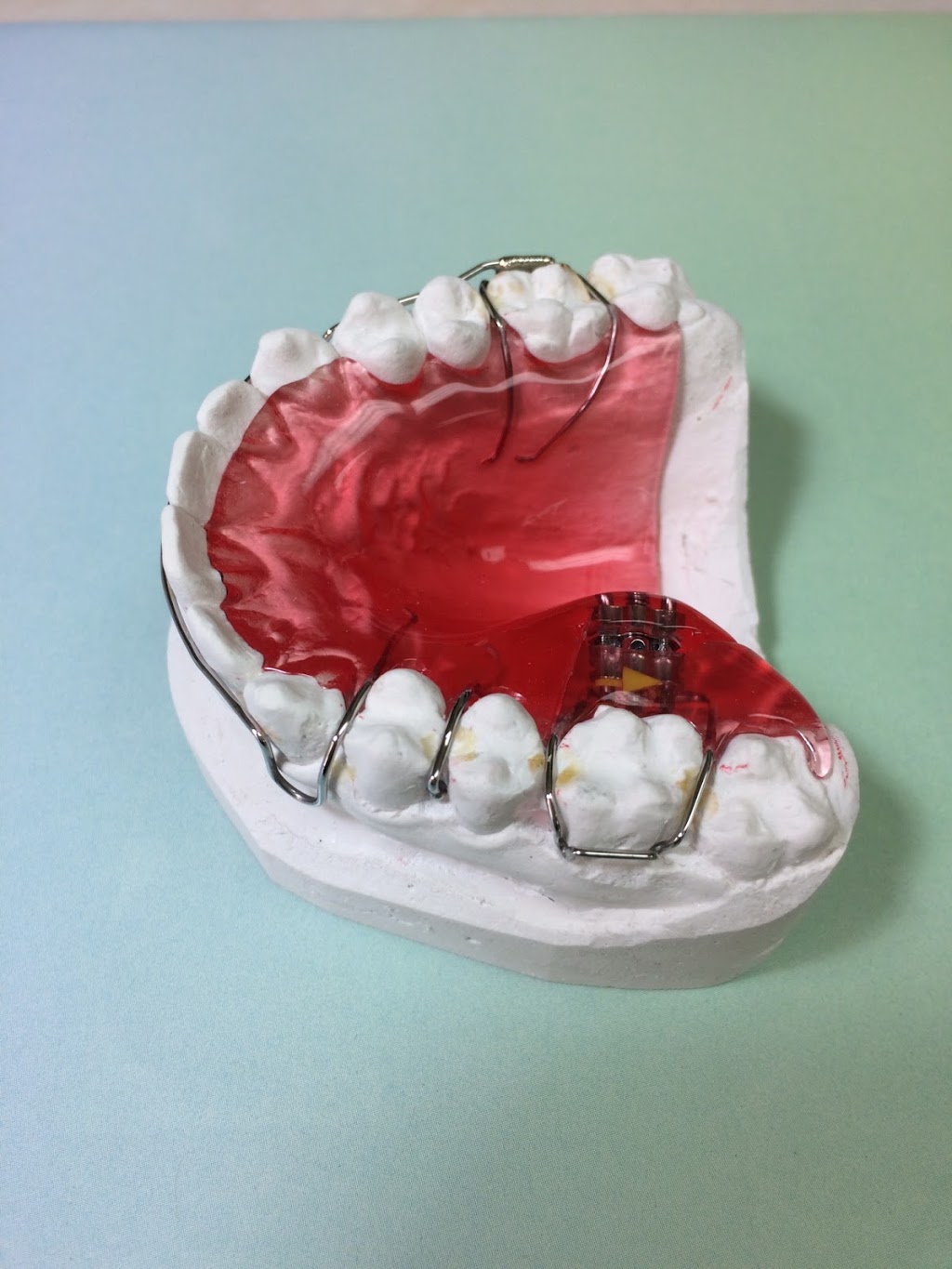 Preferred Ortho | 14065 Victoria Trail NW #207, Edmonton, AB T5Y 2B6, Canada | Phone: (780) 490-6585