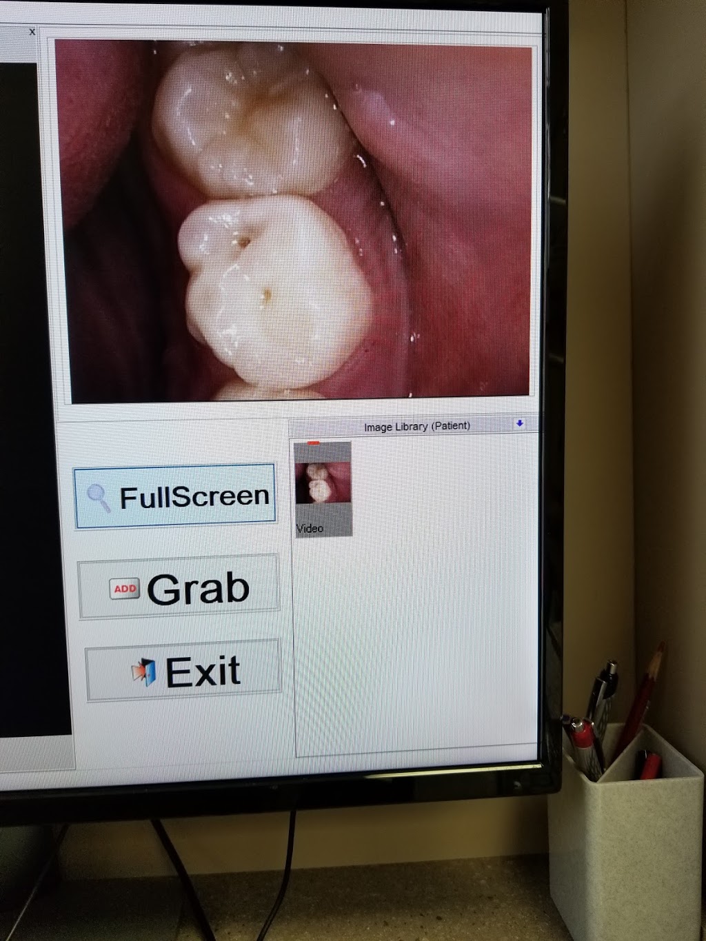 Mount Pleasant Dental Centre | 707 Mt Pleasant Rd, Toronto, ON M4S 2N4, Canada | Phone: (416) 488-8808