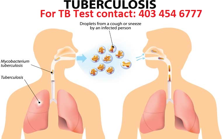 Calgary Travel Clinic - Vista | 130a-920 36 St NE, Calgary, AB T2A 6L8, Canada | Phone: (403) 460-3226