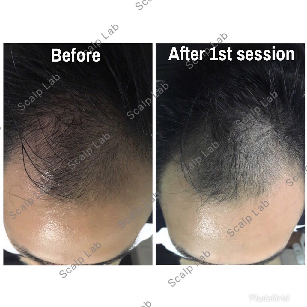 Scalp Lab | 135 Village Green Square, Scarborough, ON M1S 0G4, Canada | Phone: (416) 823-9300