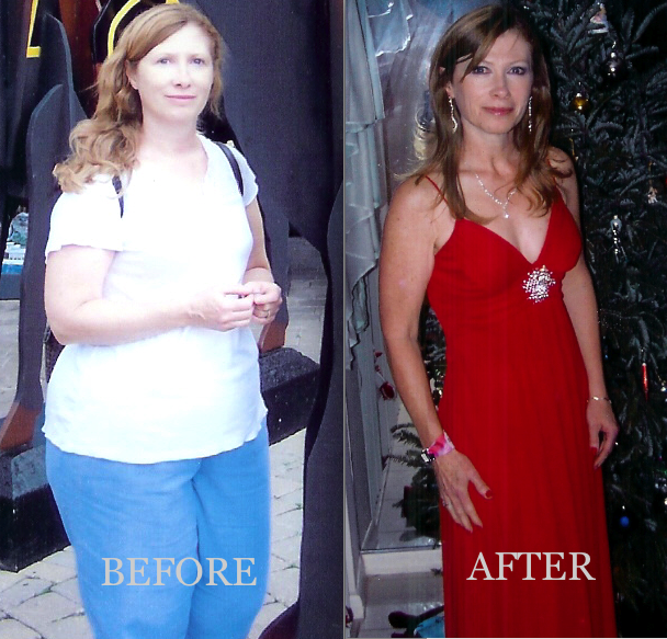Alive and Free Hypnosis & Wellness | 172 Queen St W, Brampton, ON L6X 1V7, Canada | Phone: (905) 454-7400