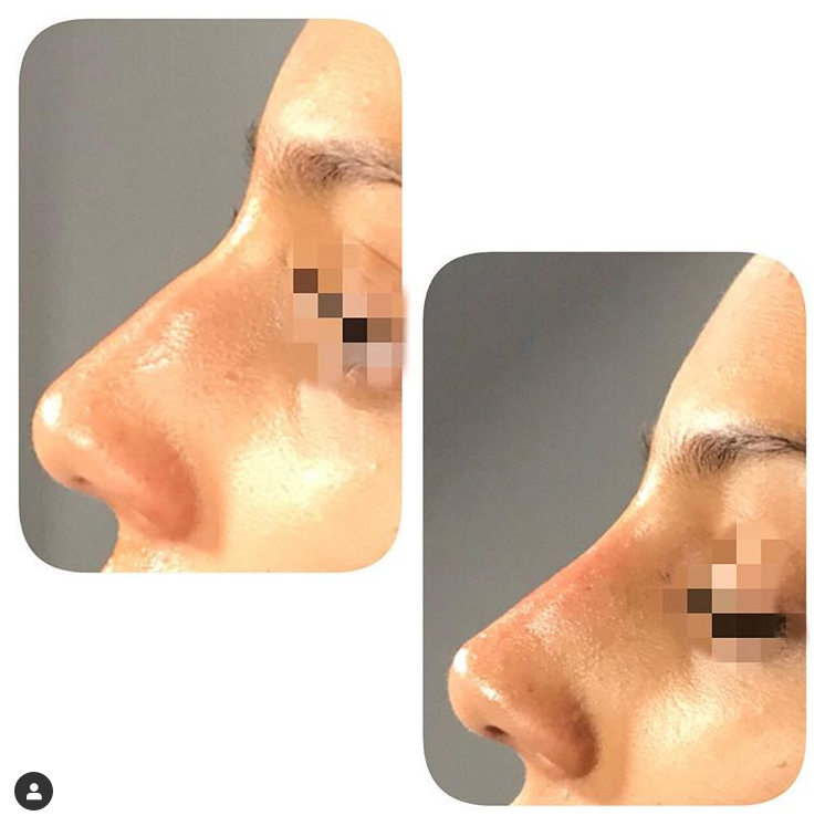 Bella Vita Injectables | 1169 Garner Rd E, Ancaster, ON L9G 3K9, Canada | Phone: (905) 327-2478