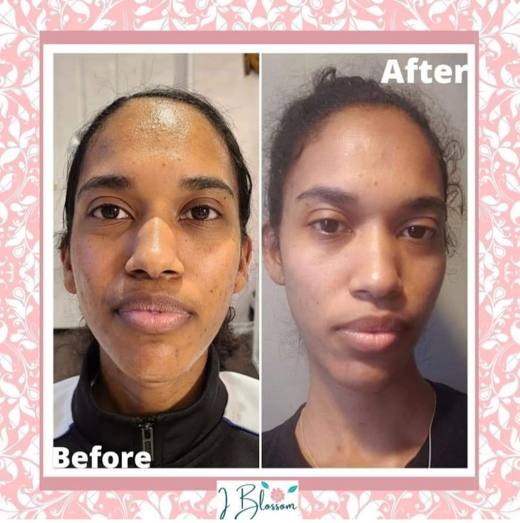 I Blossom Skincare | 119 Nash Rd S, Hamilton, ON L8K 4J8, Canada | Phone: (519) 321-0897