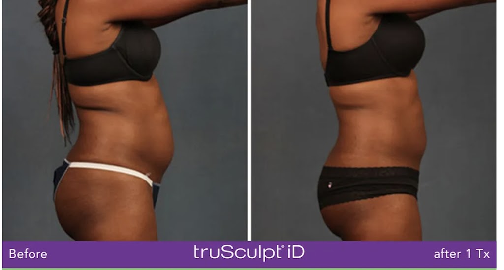 The Body Architect | 194 Sherwood Mount Northwest, Calgary, AB T3R 0G5, Canada | Phone: (403) 354-0368