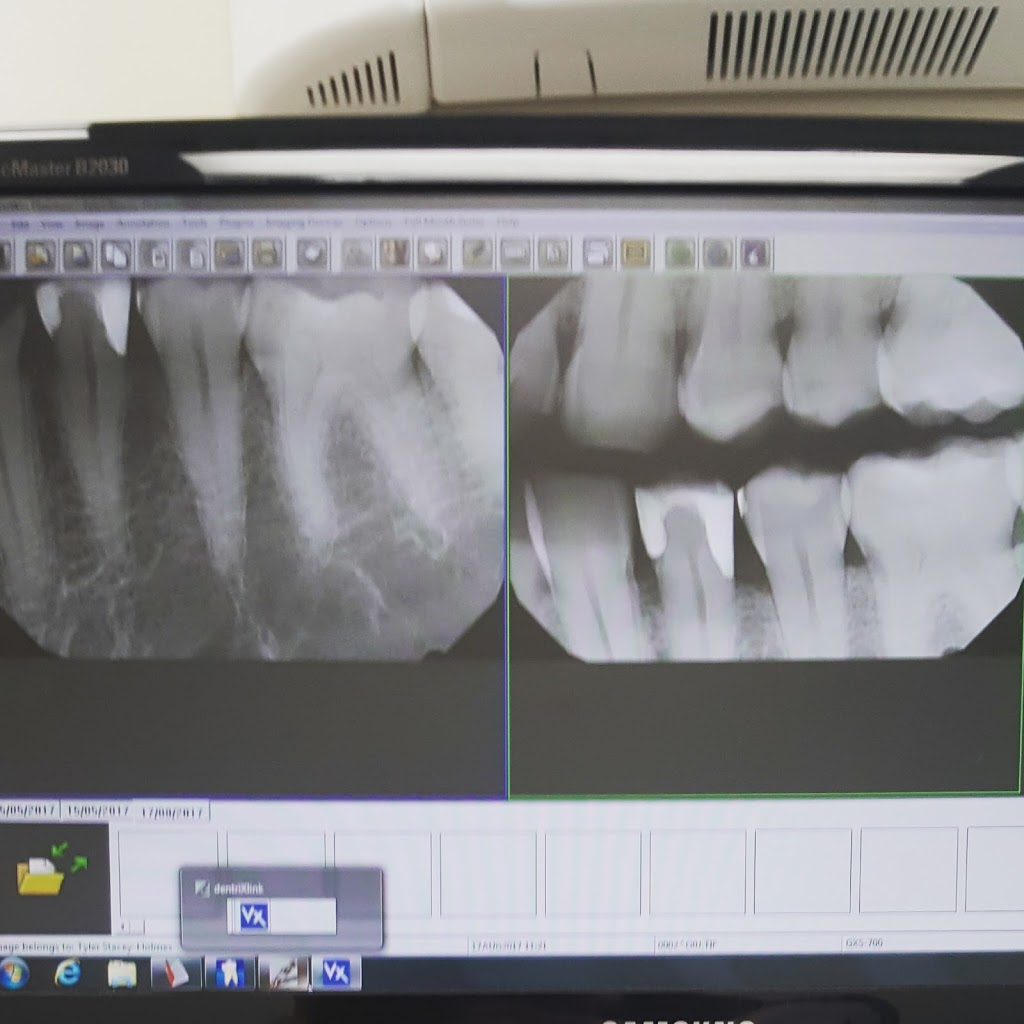 Family Dental Care - Ottawa South | 2 Lorry Greenberg Dr, Ottawa, ON K1G 5H6, Canada | Phone: (613) 736-5000