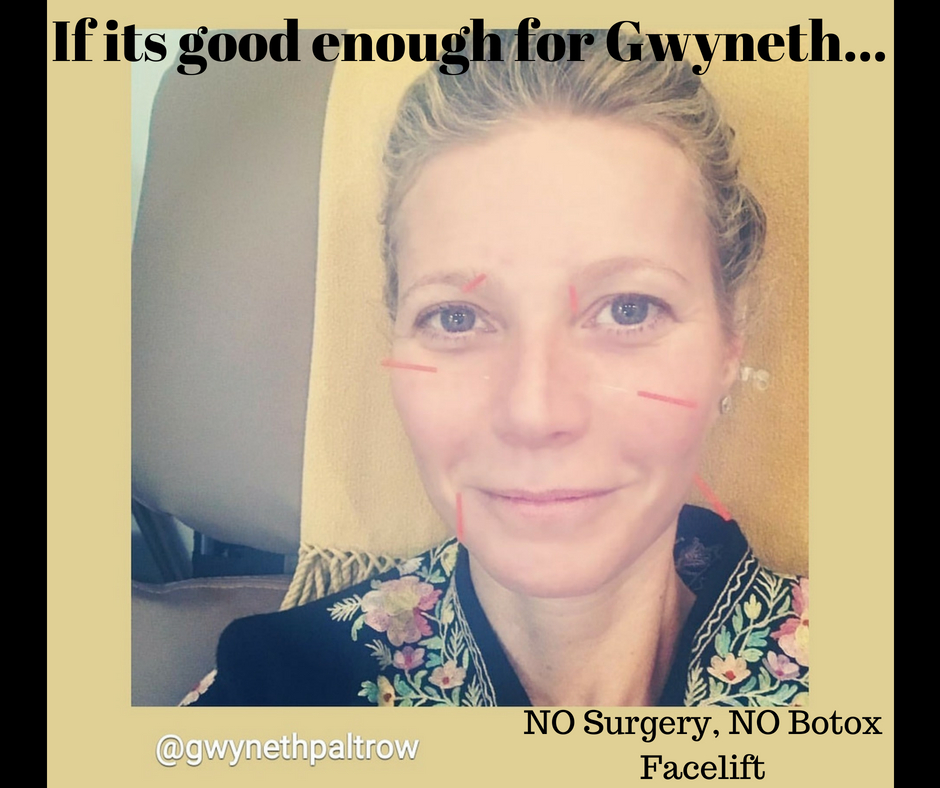 Kawartha Restorative Acupuncture | 55 Mary St W, Lindsay, ON K9V 2N6, Canada | Phone: (705) 341-8830