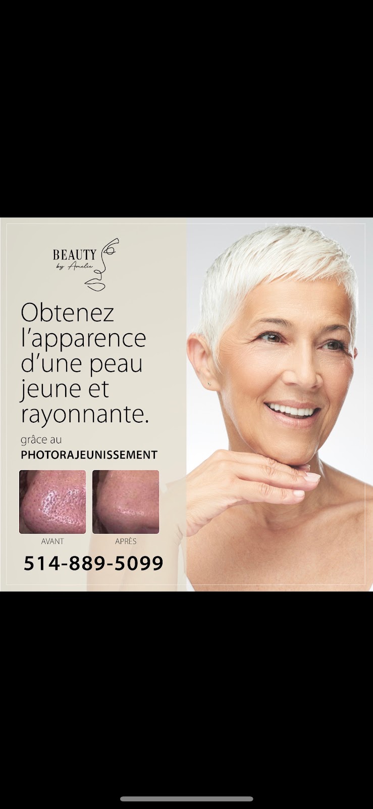 Beauty By Amelie Laser & Esthétique | Rue Victor, Mirabel, QC J7J 1B4, Canada | Phone: (514) 889-5099