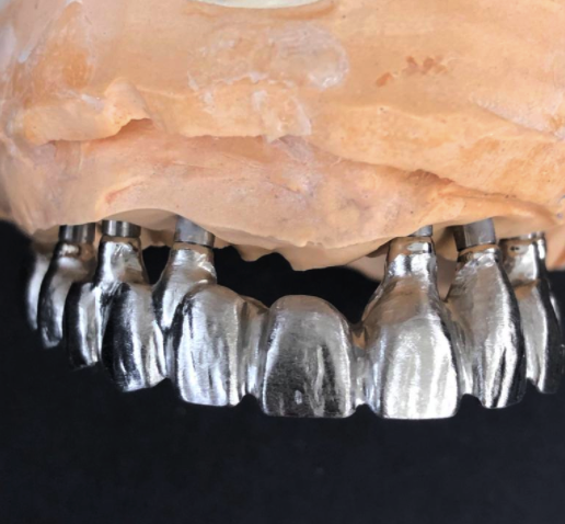 Innovative Dental Laboratories | 1706 Danforth Ave, Toronto, ON M4C 1H8, Canada | Phone: (416) 463-3138