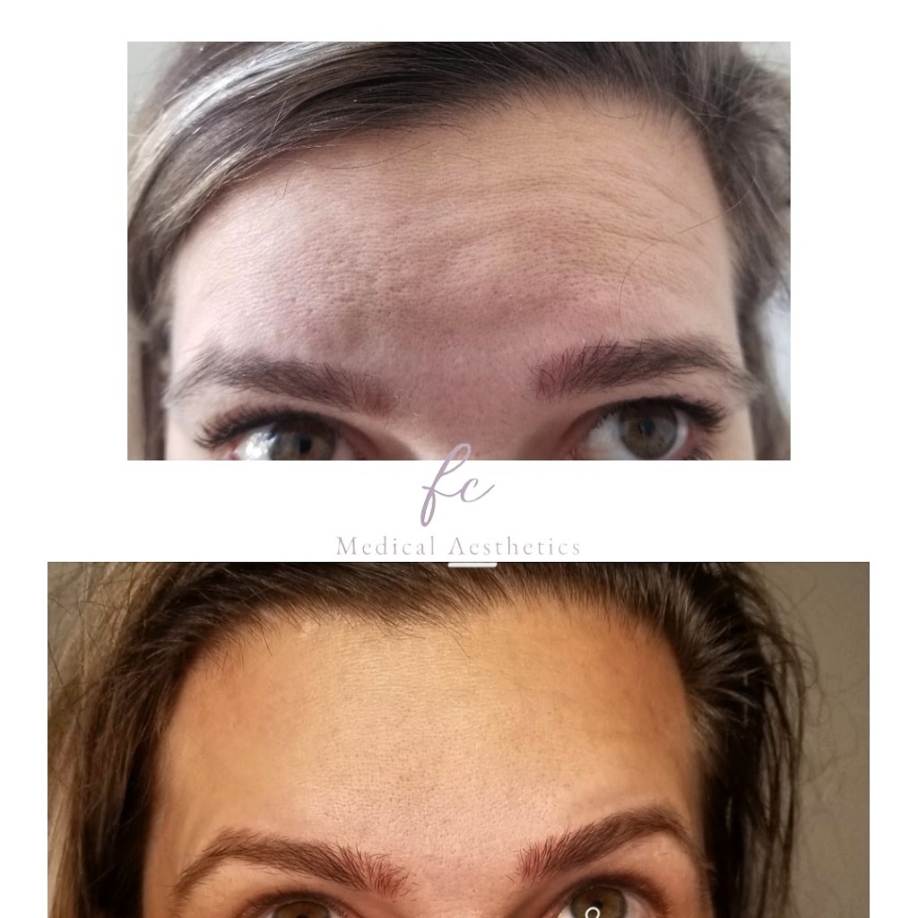 Aesthetics FC | 95 Brabin Cir, Whitby, ON L1P 0C2, Canada | Phone: (289) 200-0665
