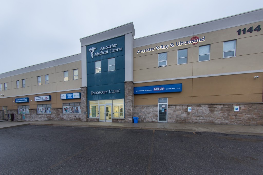 Ancaster X-Ray & Ultrasound | 104-, 1144 Wilson St W, Ancaster, ON L9G 3K9, Canada | Phone: (905) 648-5900