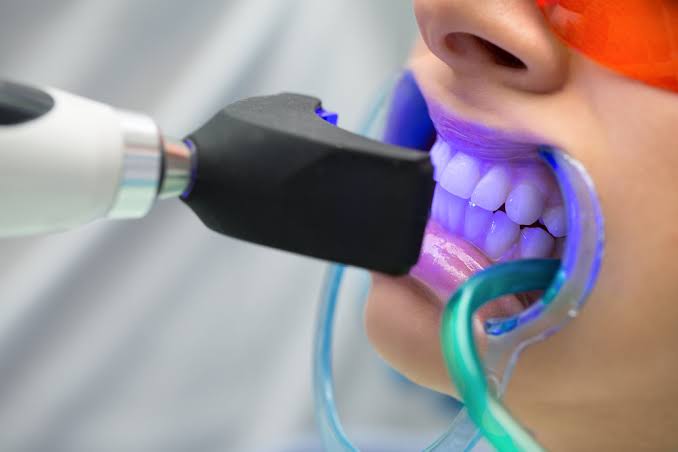The White Tooth Corner | 3050 Ellesmere Rd #1204, Scarborough, ON M1E 5E6, Canada | Phone: (647) 525-3556