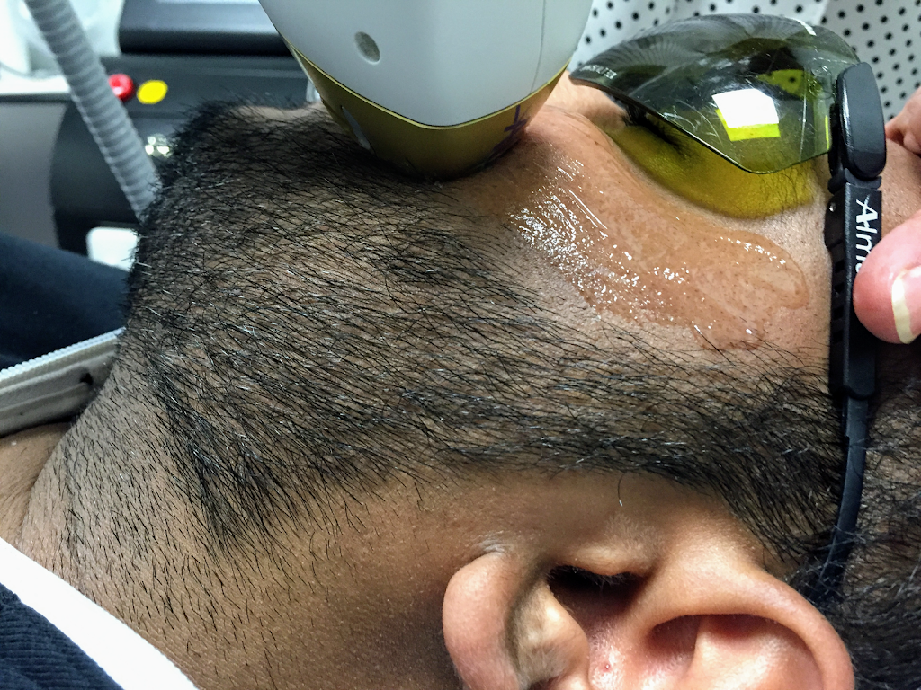 Luminous Laser & Spa | 298 Enfield Pl, Mississauga, ON L5B 3E2, Canada | Phone: (416) 710-5686