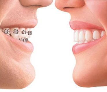 Cool Smiles | 221 Main St, East Aurora, NY 14052, USA | Phone: (716) 652-1411