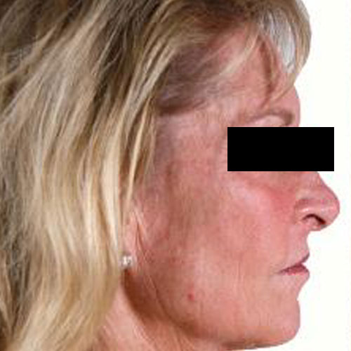 Allure Aesthetics | 790 Coventry Dr NE #114, Calgary, AB T3K 4K4, Canada | Phone: (587) 228-6614