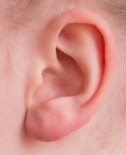 Davidson Hearing Aid Centres | 627 Fortington St, Renfrew, ON K7V 1E5, Canada | Phone: (613) 432-7171