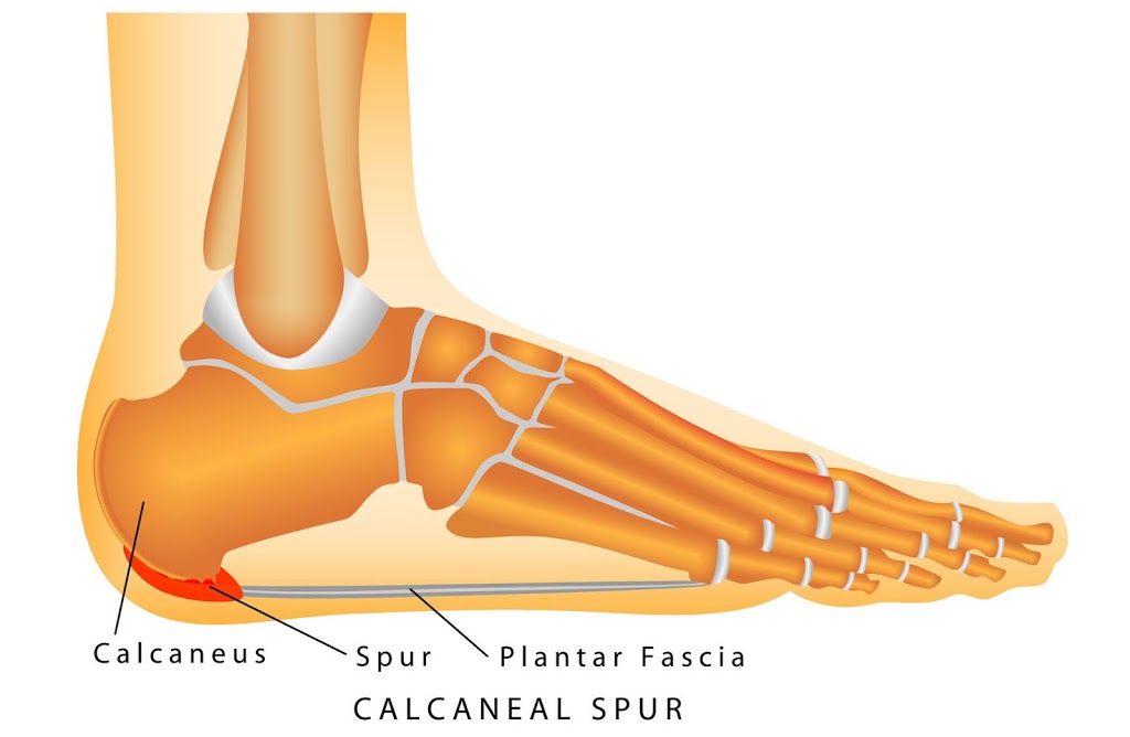 Podformance - Clinique Podiatrique | 2nd floor, 4650 Desserte sud, Aut. Laval Ouest (440), Laval, QC H7T 2Z8, Canada | Phone: (450) 688-0445 ext. 5