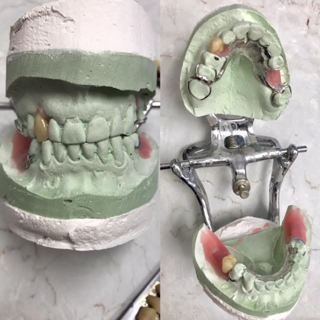 Ottawa South Denture Clinic | 2210 Prince of Wales Dr #701, Nepean, ON K2E 6Z9, Canada | Phone: (613) 695-9229