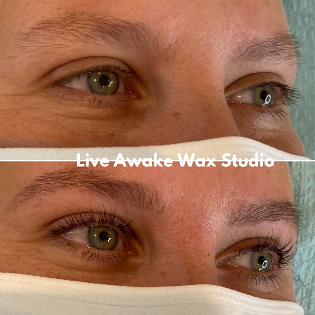 Live Awake Wax Studio & Laser Hair Removal | 20503 42 Ave, Langley, BC V3A 3A8, Canada | Phone: (604) 720-5445