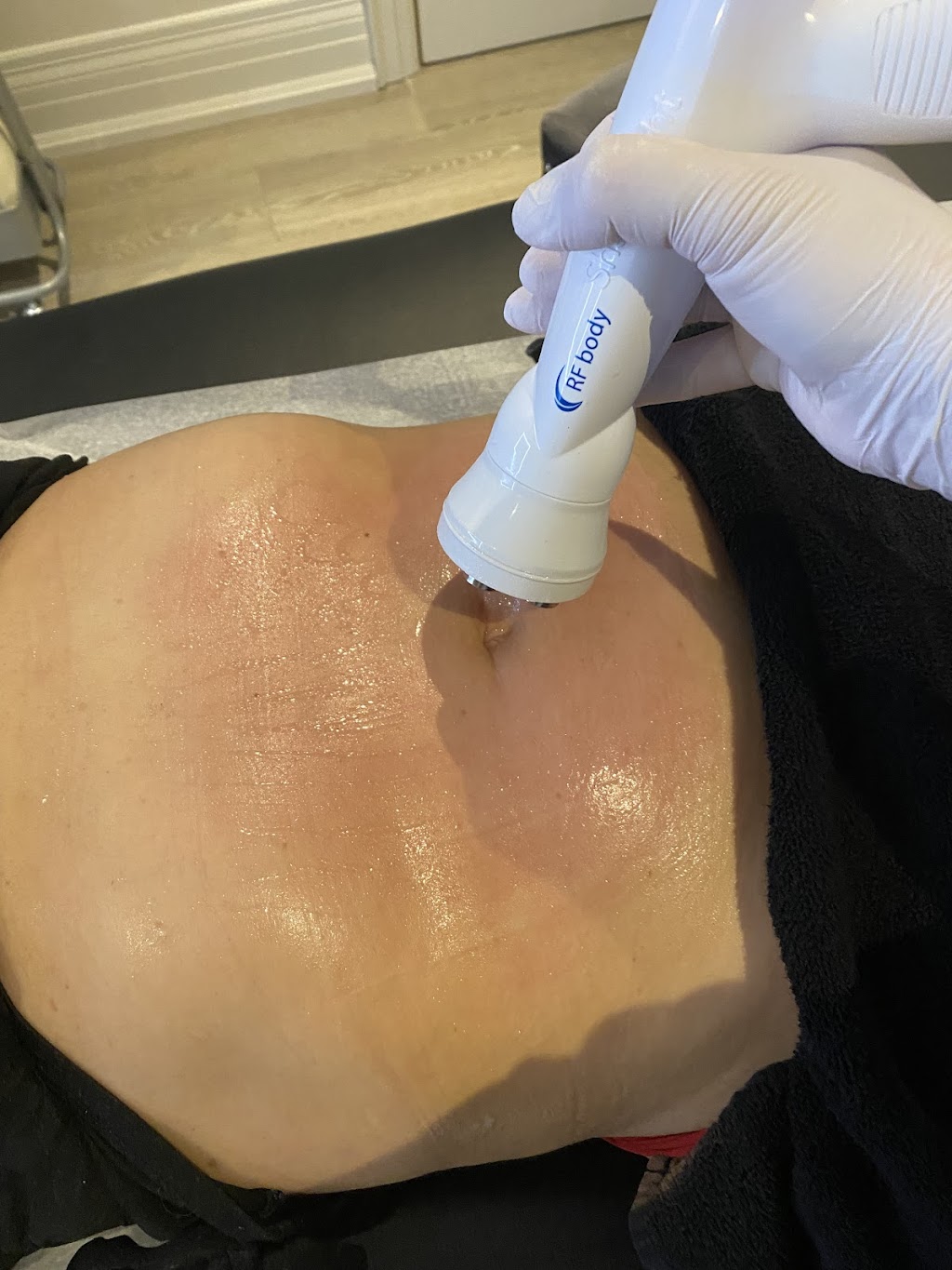Universal Laser Treatments Inc | 16 Longhouse St, Vaughan, ON L4L 4Z3, Canada | Phone: (647) 278-2211