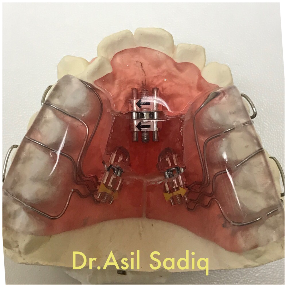 Cedar Heights Dental | 695 Markham Rd #14, Scarborough, ON M1H 2A5, Canada | Phone: (416) 438-0606
