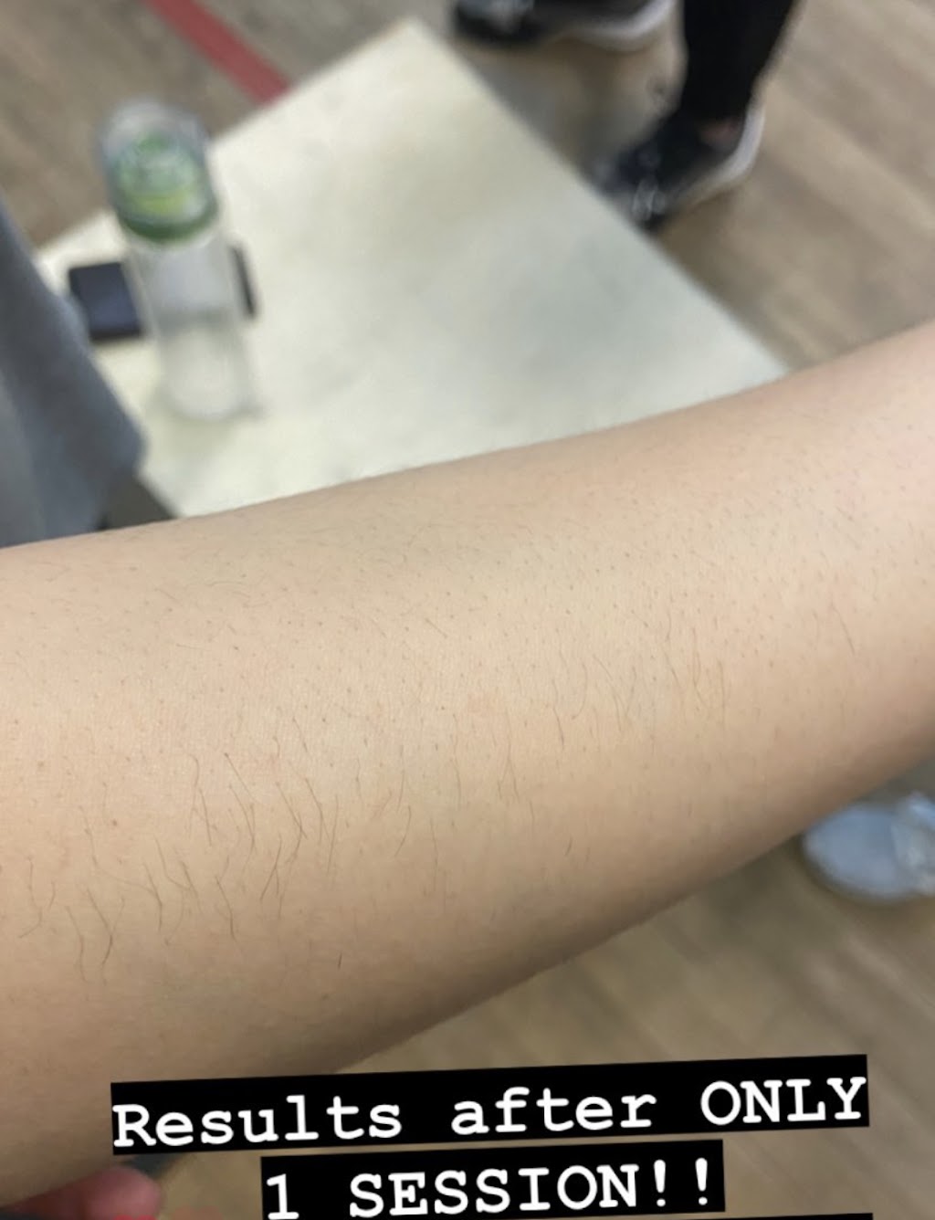 Rejuvia Aesthetics | 35 Toohey Ln, London, ON N6G 4Y2, Canada | Phone: (226) 639-5545