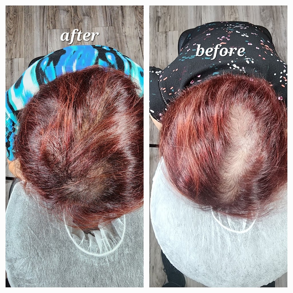 SCALP DESIGN MICROPIGMENTATION | 710 Railton Ave, London, ON N5V 4E1, Canada | Phone: (519) 673-2956