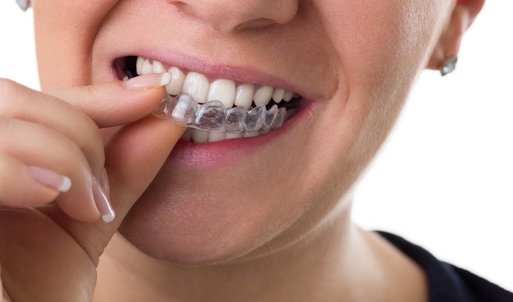 Orthodontiste Granby Alain Paquette | 206 Rue Denison E, Granby, QC J2G 4C2, Canada | Phone: (450) 378-2365