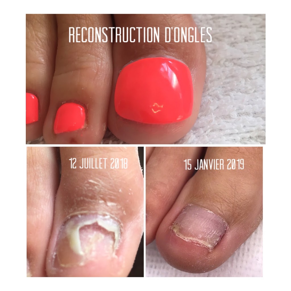 Soins des Pieds Marie-Josée Gilbert | Ville de Québec | 4096 Rue des Thuyas, Québec, QC G1G 0G6, Canada | Phone: (418) 573-7154