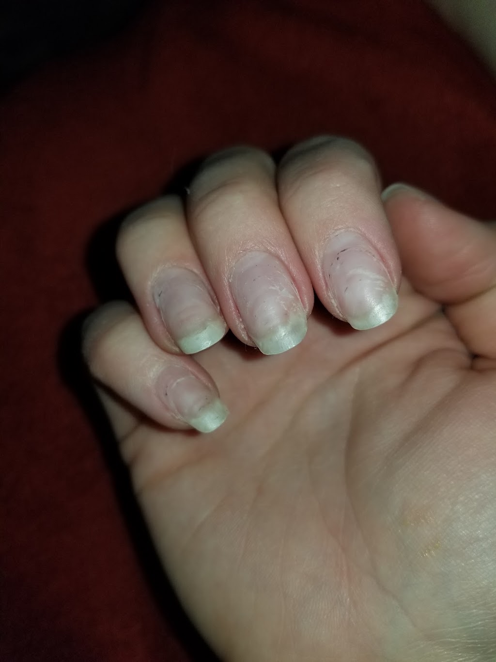 ACE OF NAILS | 2230 McPHILLIPS | GARDEN CITY | 2230 McPhillips Street Unit 1C Seven Oaks Shopping Centre, Winnipeg, MB R2V 3C8, Canada | Phone: (204) 504-0840