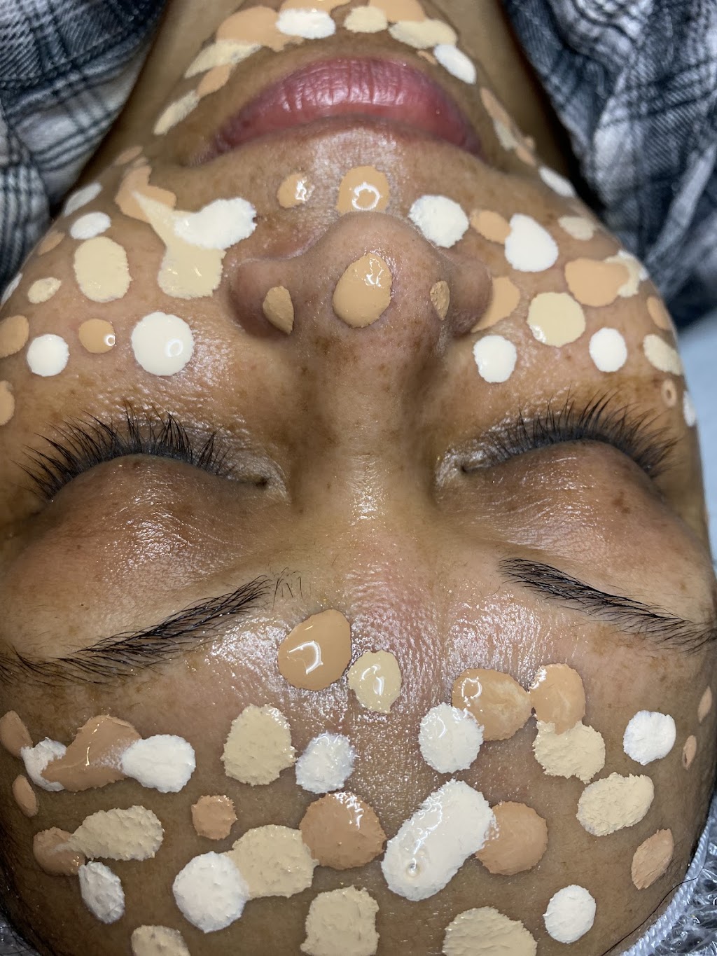 NR Laser & Spa | 7088 Justine Dr, Mississauga, ON L4T 1M3, Canada | Phone: (647) 269-1045