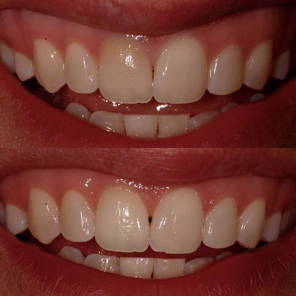 Woodbridge Vaughan Dental | 1160 Clarence St #4, Woodbridge, ON L4H 2V3, Canada | Phone: (905) 850-3443
