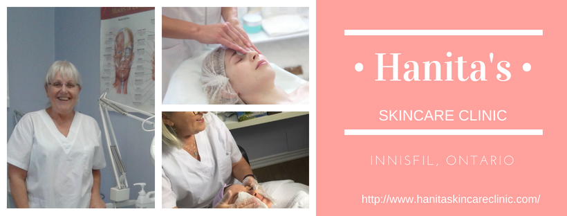 Hanitas (On-Wingrove) Skin Care Clinic | 1710 Wingrove Ave, Innisfil, ON L9S 1S5, Canada | Phone: (705) 431-1077