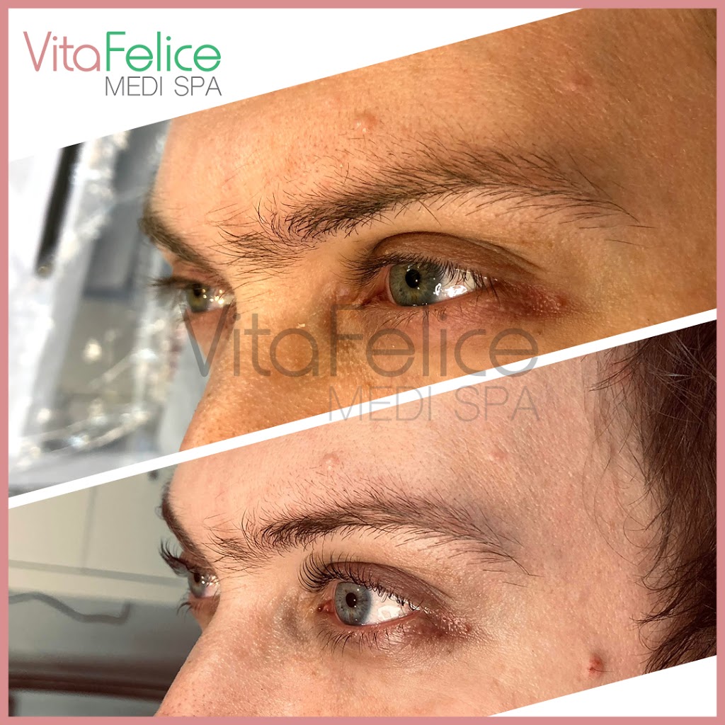 Vita Felice Medi Spa | 661 Columbia St, Unit 103, New Westminster, BC V3M 1A8, Canada | Phone: (778) 987-5480