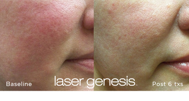 Profile Medical Cosmetics | 1415 1st Ave W Suite #3004, Owen Sound, ON N4K 4K8, Canada | Phone: (519) 270-0833