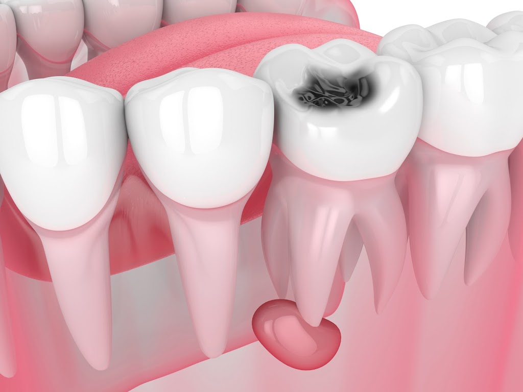 CompuSmiles Inc Denture Clinic | 1700 Corydon Ave #209, Winnipeg, MB R3N 0K1, Canada | Phone: (204) 487-7237