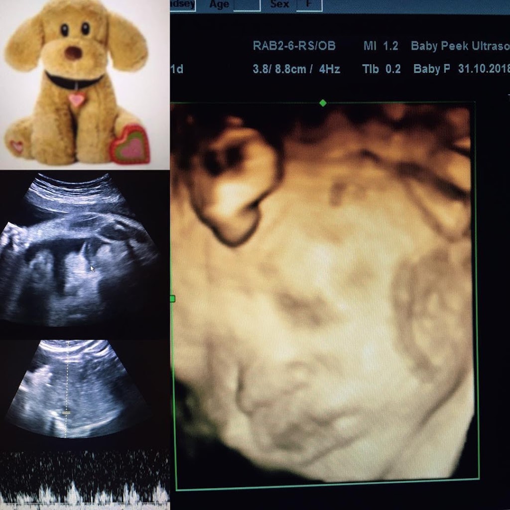 Baby Peek Ultrasound Inc | 28016 Township Rd 540, Spruce Grove, AB T7X 3V4, Canada | Phone: (780) 901-8313