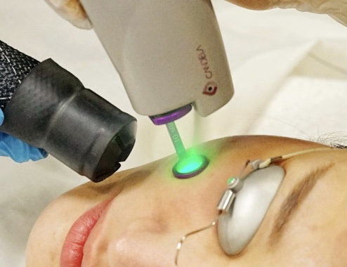 Mernov Medi Spa | 8500 Warden Ave, Markham, ON L6G 1A5, Canada | Phone: (905) 470-8522