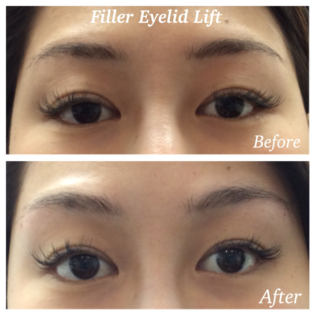 Richmond Cosmetic Clinic | 11300 No 5 Rd Suite 110, Richmond, BC V7A 5J7, Canada | Phone: (778) 960-7893