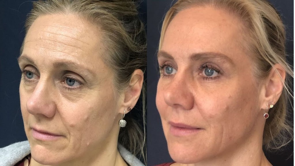 White Rock Skin and Laser Clinic | 15850 26 Ave #101, Surrey, BC V3Z 2N6, Canada | Phone: (778) 545-1925