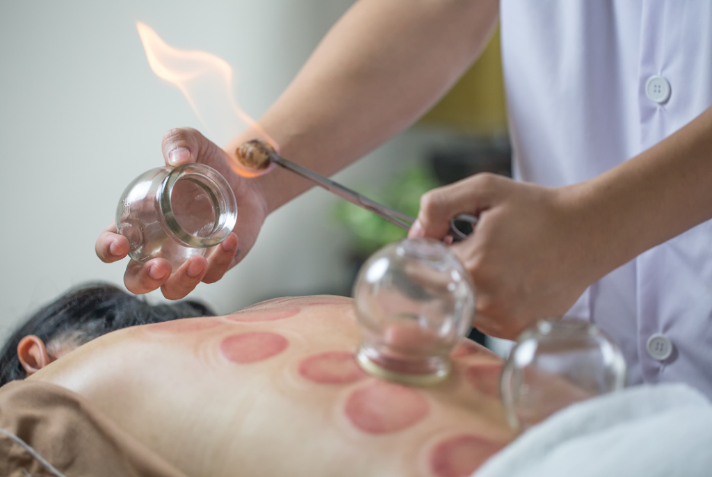 Balance To Heal Acupuncture | 304 Cranberry Park SE unit 202, Calgary, AB T3M 1W2, Canada | Phone: (705) 500-6601