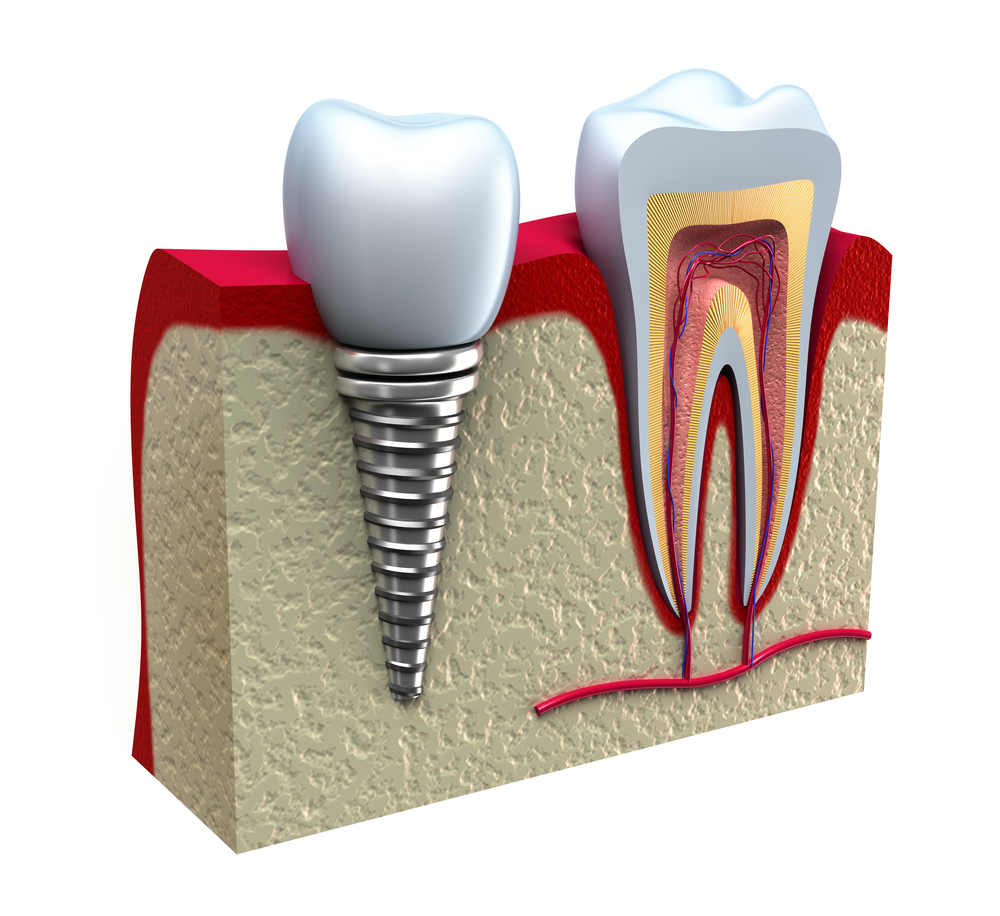 Sandalwood Dental | 50 Bristol Rd E, Mississauga, ON L4Z 3K8, Canada | Phone: (905) 568-4900