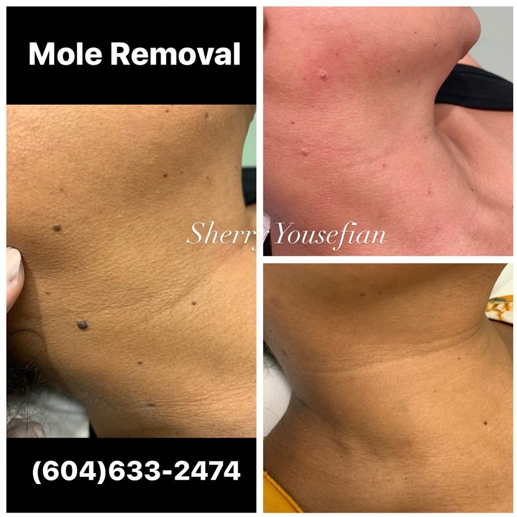 Medic laser and Skin care | 1296 Pacific Blvd, Vancouver, BC V6Z 2V1, Canada | Phone: (604) 633-2474