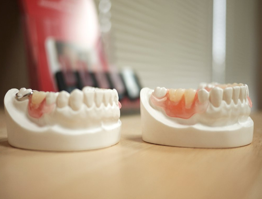Fort York Dentist Clinic | 219 Fort York Blvd #107, Toronto, ON M5V 1B1, Canada | Phone: (647) 346-8888