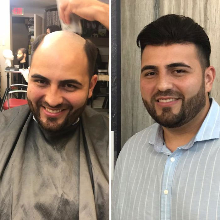 ProHair | 1112 Austin Ave unit 102 - B, Coquitlam, BC V3K 3P5, Canada | Phone: (778) 206-4247