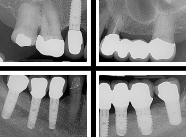 Smile Dental Implant Center - White Rock Dentists & Dental Implants | 1959 152 St, Surrey, BC V4A 9E3, Canada | Phone: (604) 531-3344