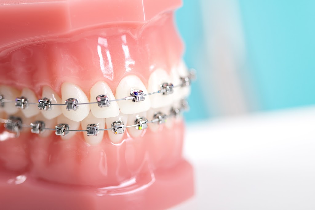 Clinique Dr Alain Chaumont Orthodontiste | 1435 Boulevard Saint-Martin O #608, Laval, QC H7S 2C6, Canada | Phone: (450) 668-9422