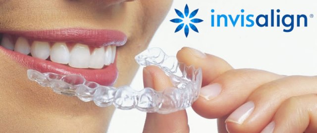 Family Dental - Dr. Khattab & Associates | 2916 Sheppard Ave E, Scarborough, ON M1T 3J4, Canada | Phone: (647) 347-2227