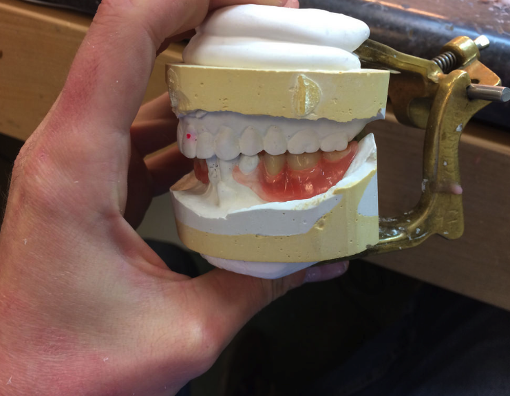 Denturologiste Repentigny Houle-Dubois | 293 Boulevard Iberville #2, Repentigny, QC J6A 2A4, Canada | Phone: (450) 581-3751