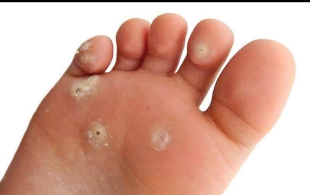 Pieds parfaits | 511 Rue Arthur-Laliberté, Granby, QC J2H 0H3, Canada | Phone: (579) 488-7359