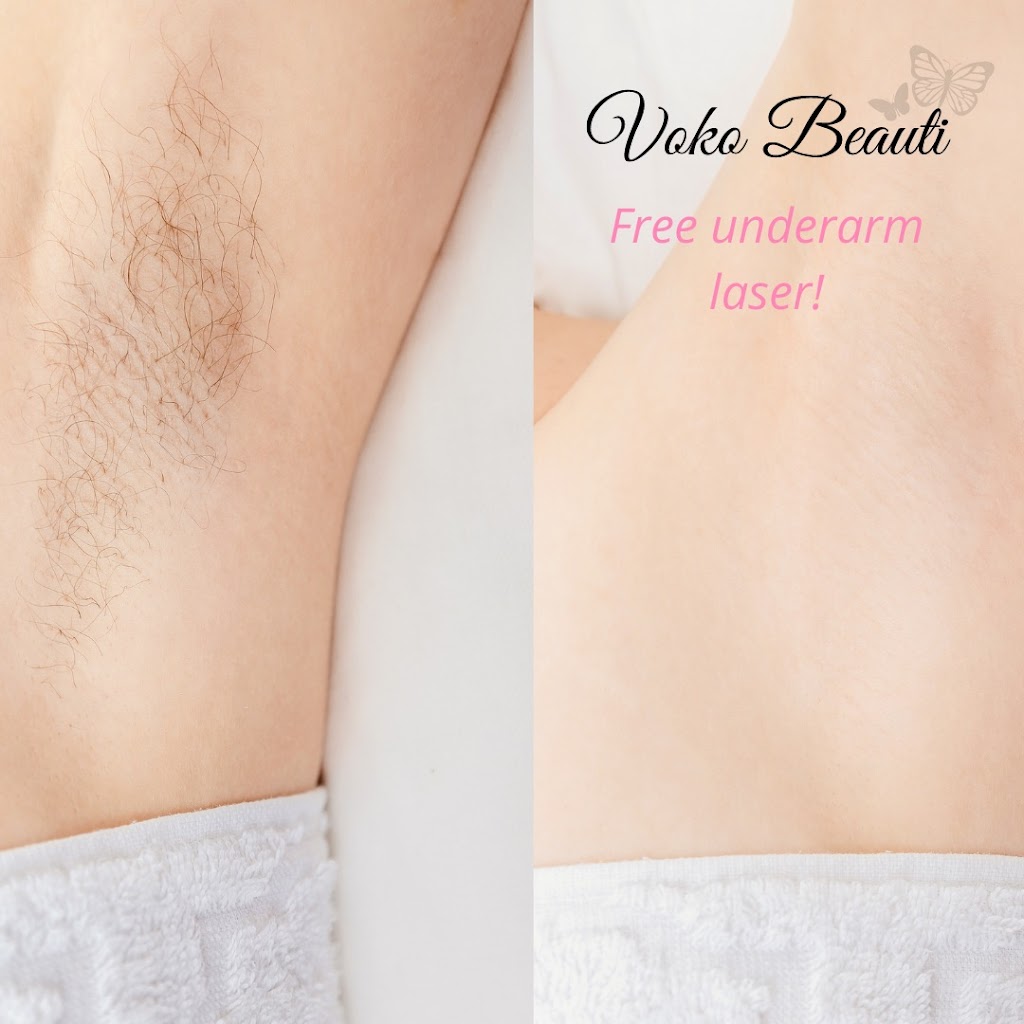 Voko Beauti Laser Hair Removal & Skin Care Clinic Chilliwack | 6396 Sumas Prairie Rd #3, Chilliwack, BC V2R 4N6, Canada | Phone: (778) 539-5577